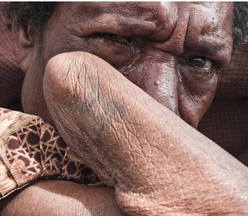 Woman not witch! A lady in Papua New Guinea has had her arm brutally cut off